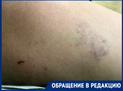 Просто шла и даже не обращала внимания: очередное нападение бездомной собаки в парке поселка Нежданная