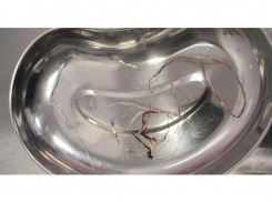 Ветеринары из Шахт прооперировали кошку, которая проглотила мишуру