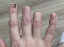 Шахтинка лишилась двух фаланг пальцев, упав вместе со столом в кафе