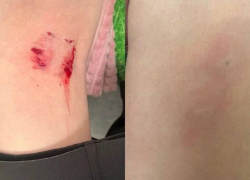 Председатель СК России взял на контроль ход расследования нападения безнадзорных собак на детей и женщину в Шахтах