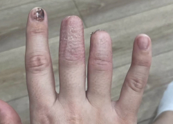 Шахтинка лишилась двух фаланг пальцев, упав вместе со столом в кафе