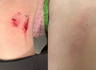 Председатель СК России взял на контроль ход расследования нападения безнадзорных собак на детей и женщину в Шахтах