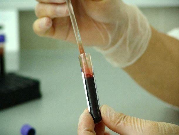 В Шахтах выявлены новые ВИЧ-инфицированные