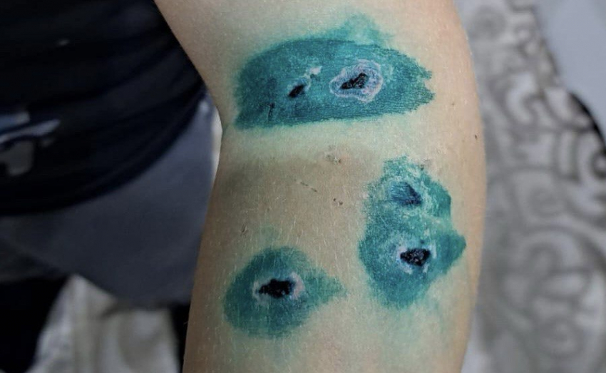 Бездомная собака напала на ребенка в детском саду в Шахтах