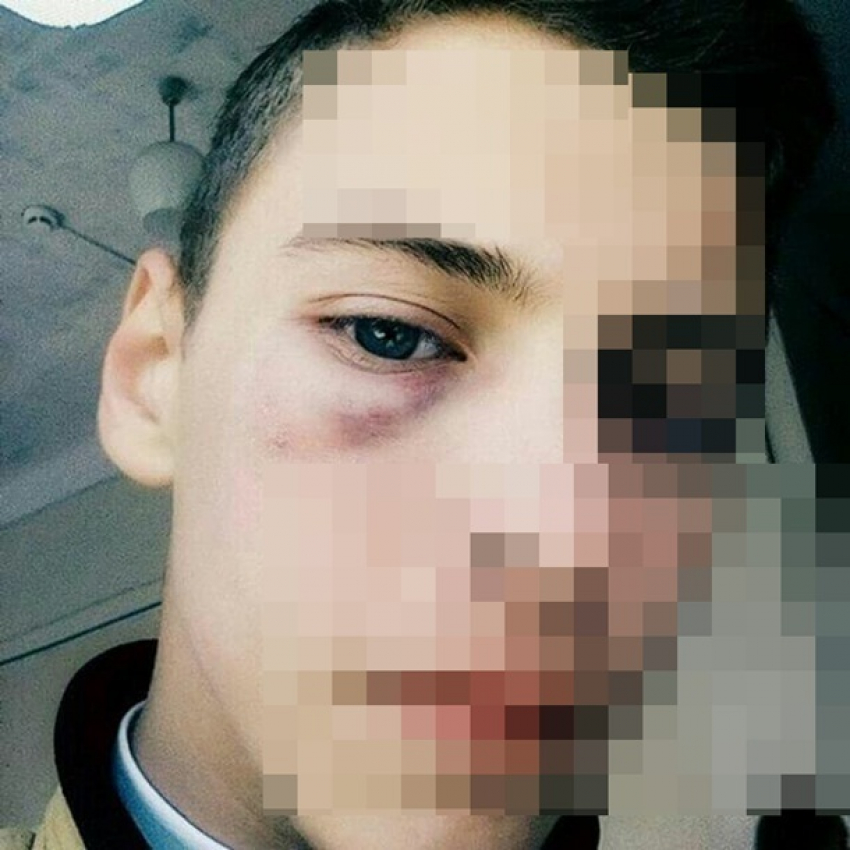 Двое взрослых мужчин напали и избили 16-летнего подроста, чтобы отобрать у него телефон в Шахтах